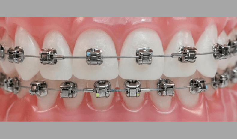 APARELHOS AUTOLIGADOS